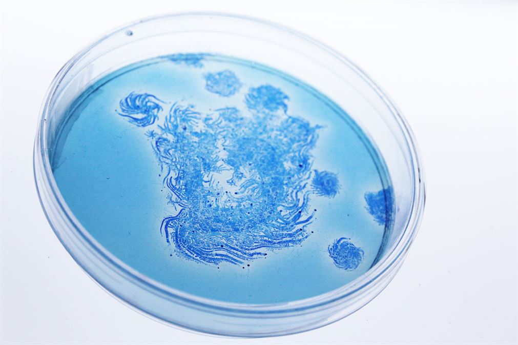 3050567-slide-s-7-a-living-typeface-grown-from-bacteria