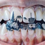 טרנד חדש בסין: צעירים נוטשים קעקועי גוף לטובת קעקועי שיניים